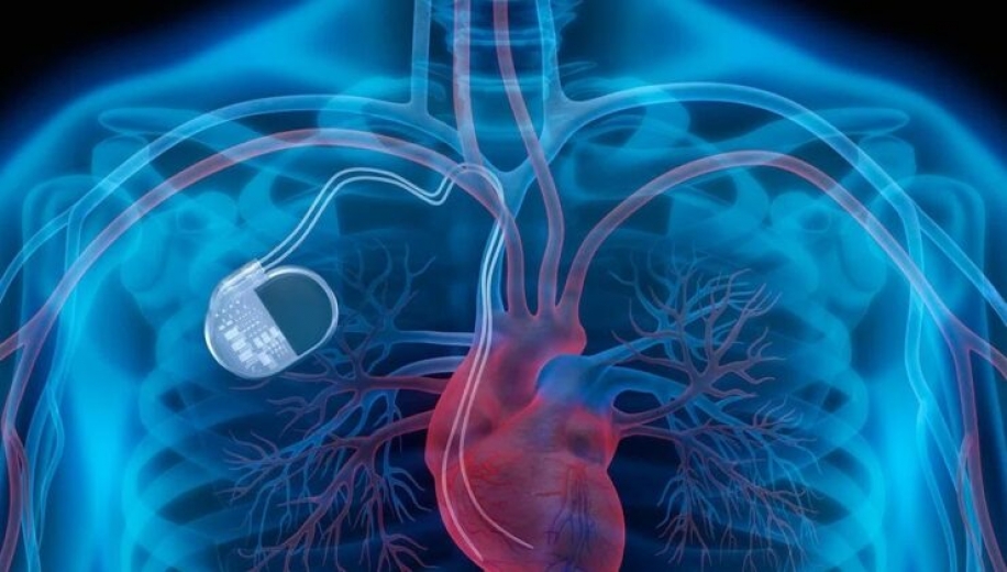 Kalıcı Kalp Pili Olanların Uyması Gereken 8 Kural